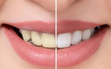 പല്ലിലെ കറ കളയാം ഈസിയായി..