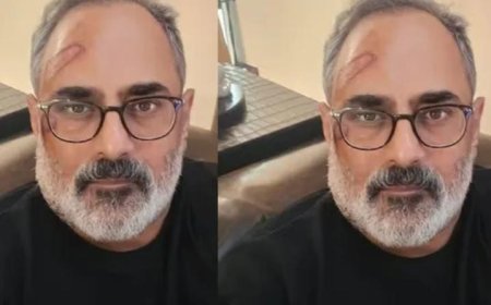 രാജീവ് ചന്ദ്രശേഖറിന് ട്രെഡ്മില്ലിൽ നിന്ന് വീണ് പരിക്ക്:::! 'ട്രെഡ്മില്ലിൽ ഫോൺഉപയോഗിക്കുമ്പോൾ അതീവ ജാഗ്രത പാലിക്കുക' !