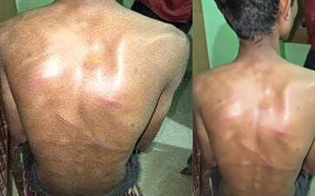 *മകളുടെ ഫോണിലൂടെ ചാറ്റ് ചെയ്ത് പിതാവ്, 17കാരനെ രാത്രി വീട്ടില്‍ നിന്ന് പുറത്തിറക്കി; ക്രൂരമര്‍ദ്ദനം; അറസ്റ്റ്*