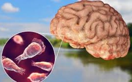 *പതിമൂന്ന് വയസ്സുകാരന് മസ്തിഷ്‌ക ജ്വരം, രോഗം സ്ഥിരീകരിച്ചത് നേത്രപരിശോധനയ്ക്ക് എത്തിയപ്പോൾ*