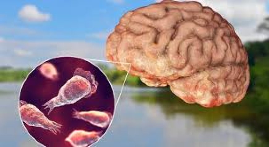 *പതിമൂന്ന് വയസ്സുകാരന് മസ്തിഷ്‌ക ജ്വരം, രോഗം സ്ഥിരീകരിച്ചത് നേത്രപരിശോധനയ്ക്ക് എത്തിയപ്പോൾ*