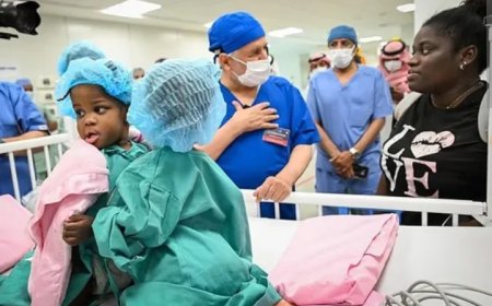 ഇരുപത് മാസം മാത്രം പ്രായമുള്ള ജമൈക്കൻ സയാമീസ് ഇരട്ടയെ വേർപിരിക്കാനുള്ള ശസ്ത്രക്രിയ റിയാദിൽ പുരോഗമിക്കുന്നു