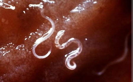 കൃമി ശല്യം ഉള്ളവർ സൂക്ഷിക്കുക....