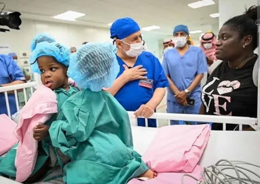 ഇരുപത് മാസം മാത്രം പ്രായമുള്ള ജമൈക്കൻ സയാമീസ് ഇരട്ടയെ വേർപിരിക്കാനുള്ള ശസ്ത്രക്രിയ റിയാദിൽ പുരോഗമിക്കുന്നു