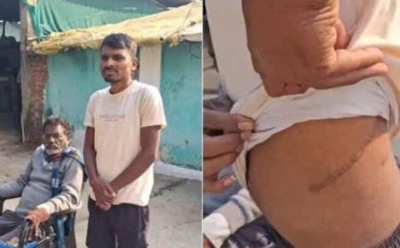 ഒരു ലക്ഷം രൂപയുടെ വായ്പ പലിശ കയറി 74 ലക്ഷം രൂപയായി; മഹാരാഷ്ട്രയിൽ പണമിടപാടുകാരുടെ നിർബന്ധത്തിൽ വൃക്ക വിറ്റ് കർഷകൻ