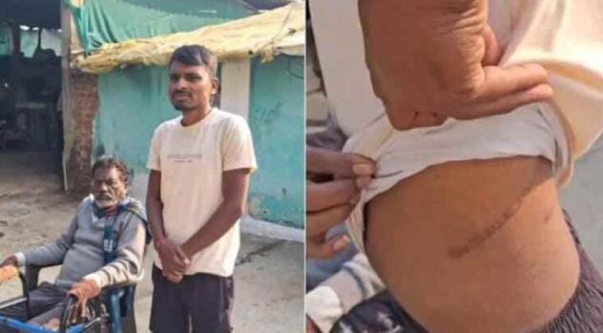 ഒരു ലക്ഷം രൂപയുടെ വായ്പ പലിശ കയറി 74 ലക്ഷം രൂപയായി; മഹാരാഷ്ട്രയിൽ പണമിടപാടുകാരുടെ നിർബന്ധത്തിൽ വൃക്ക വിറ്റ് കർഷകൻ