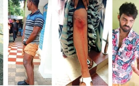 വിഴിഞ്ഞത്ത് തെരുവുനായ ആക്രമണം; കടിച്ചത്പേവിഷബാധയേറ്റ നായയെന്ന് സംശയംഎട്ടുപേർക്ക് കടിയേറ്റു