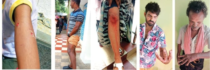 വിഴിഞ്ഞത്ത് തെരുവുനായ ആക്രമണം; കടിച്ചത്പേവിഷബാധയേറ്റ നായയെന്ന് സംശയംഎട്ടുപേർക്ക് കടിയേറ്റു